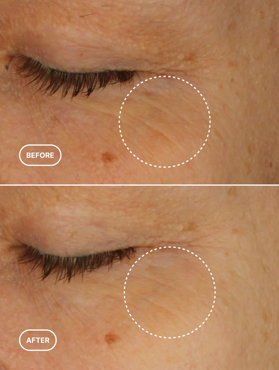 Retinol Alternative Eye Serum